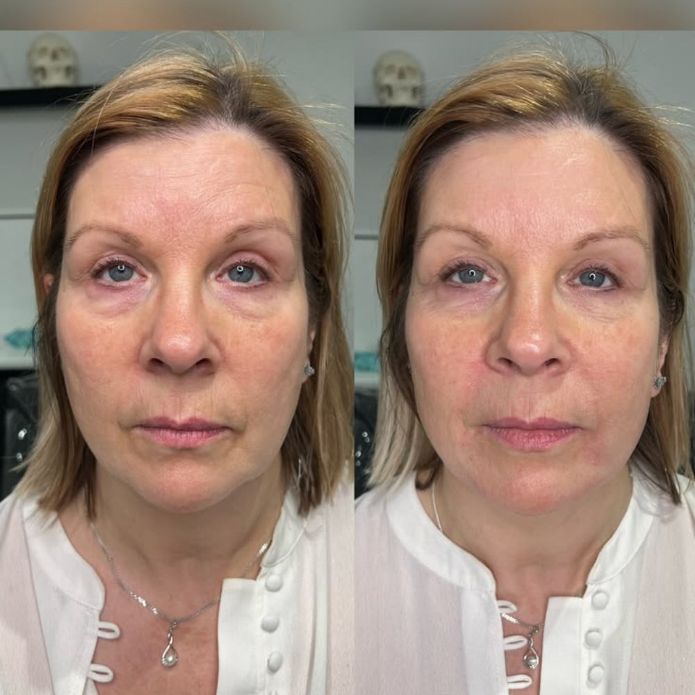 Nathalie, 54 ans